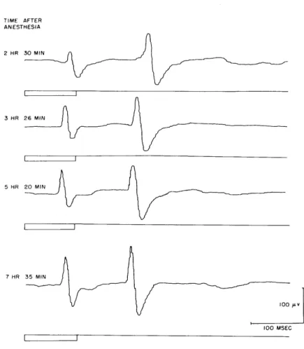 Fig.  XVIII-5.  Evoked  cortical  potentials  from  vis- vis-ual  association  area  to  a  100-msec flash  of  low  intensity