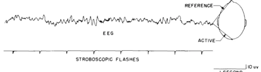Fig.  XI-5.  Potentials  recorded  from  skull  of  subject  receiving stroboscopic  flashes  at  times  indicated  by  pips