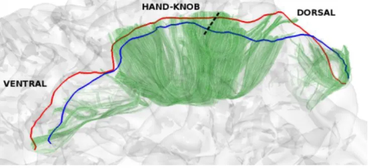 Fig. 2. Dorso-ventral view of one subject: pre- (red),  post- (blue) central gyri crests and resulting U-shape  streamlines (green) behind the left white matter mesh