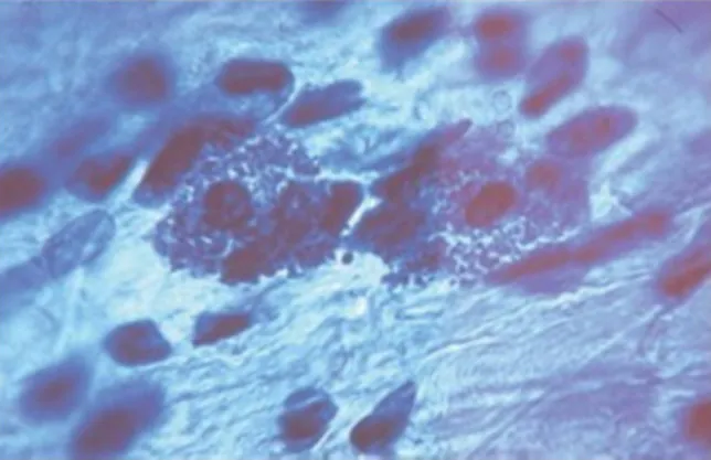 Figure 8: Mastocytes en microscopie optique : le noyau disparaît sous les granulations  cytoplasmiques [10] 