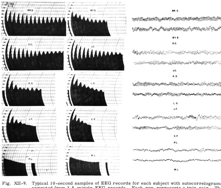 Fig.  XII-9.  Typical  10-second  samples  of  EEG  records  for  each  subject  with  autocorrelograms computed  from  3
