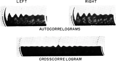 Fig.  XII-5.  Autocorrelograms  and  crosscorrelogram  for  a 1-minute  EEG  recording before  drug  injection