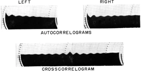 Fig.  XII-8.  Autocorrelograms  and  crosscorrelogram  for  a  1-minute  recording made  after the  EEG  had  returned  to  its  normal  (preinjection)  state.