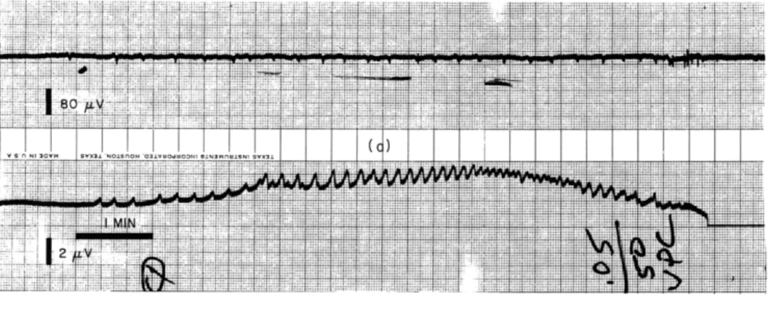 Fig.  XVI-9.  Simultaneous  recordings  from  a  gross  40-gauge  platinum  electrode  with  a Grass  P511  R  amplifier  in  (a)  and  extracellular  microelectrode  (0