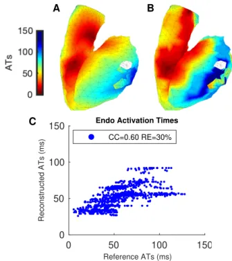 Figure 6. CC only on the neighborhood of the scar, four pacing sites, left ventricular scar