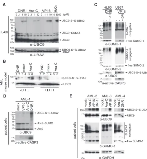 Figure 3. Chemotherapeutic Drug-Induced ROS Inhibit SUMO-E1 and E2 Enzymes (A) HL60 cells were treated with Ara-C, VP16, or DNR for 7 hr or H 2 O 2 (15 min), lysed in a  nonre-ducing sample buffer and immunoblotted for UBC9 and UBA2.