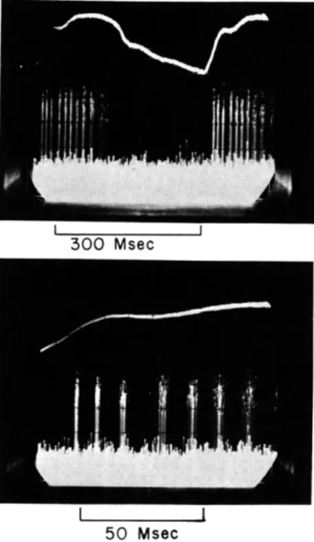 Figure  XXXI-11  shows  the  pressure  waveform  and  associated  firing  pattern  on  a single  common-carotid  pressure  receptor  nerve  of  an  anaesthetized  cat  in  a  particular