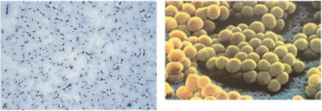 Figure 8:A) Gram de S.aureus ;B) Staphylocoques en  microscopie à balayage [60]. 