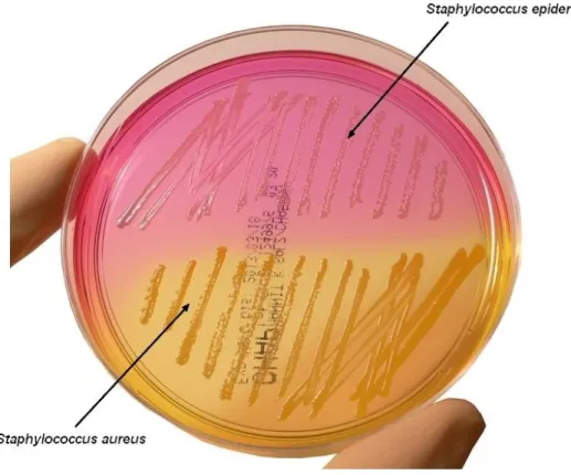 Figure 10: Culture sur milieu de Chapman. 