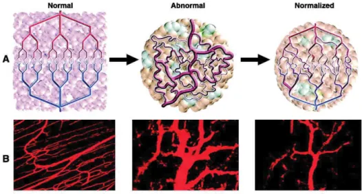 Figure 8.Normalization of tumor vasculature.Hypothesized effects of tumor vessel normalization