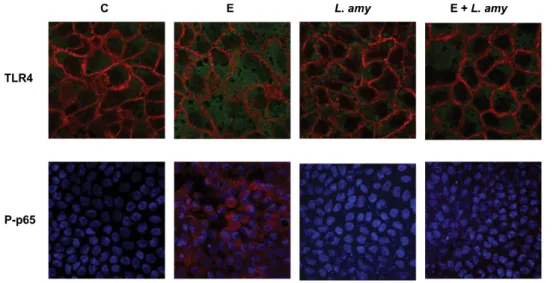 Figure 2. Inhibition of ETEC induced TLR-4 up-regulation and P-p65 translocation into the nucleus by L