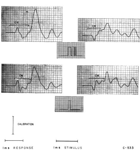 Fig.  XIII-  1I.