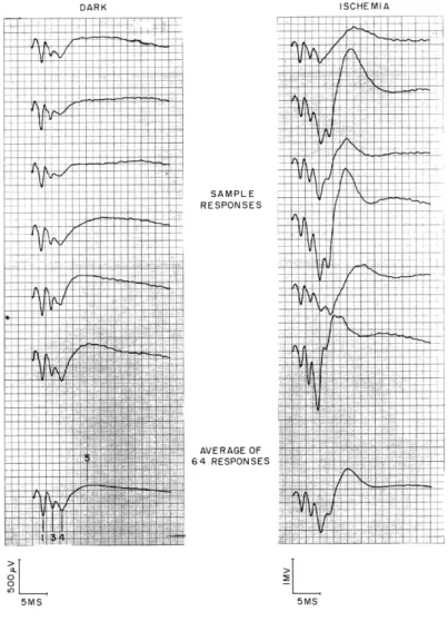 Fig.  XXII-1. Stability  of the  average  of  responses.  Potentials  recorded  by  monopolar electrodes  from  striate  cortex  after  delivery  of  shocks  to  the   corre-sponding  lateral  geniculate  body