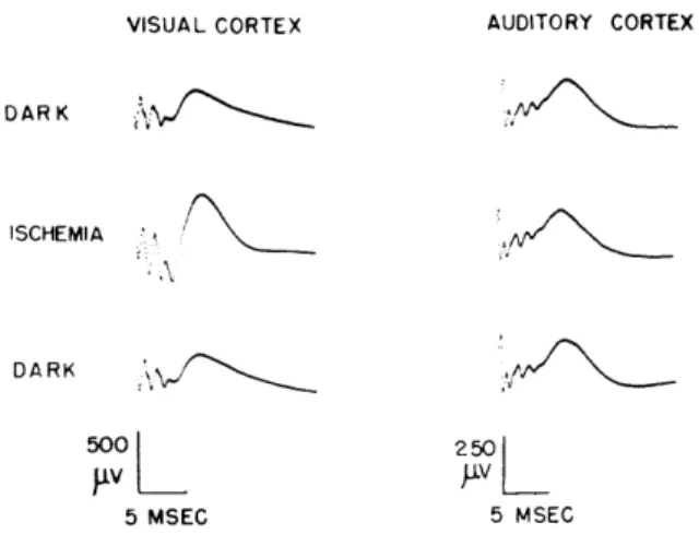 Fig.  XXII-2.  Averages  of  cortical  responses  from  shocks  delivered  to  the  lateral geniculate  body  and  the  medial  geniculate  body  for  different  retinal   con-ditions