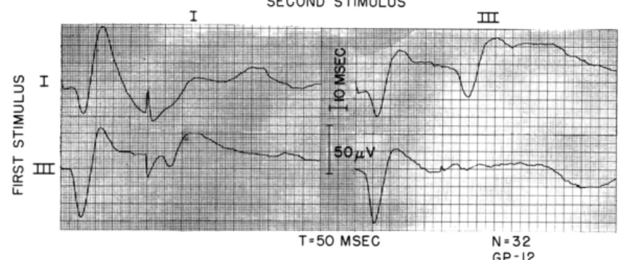 Fig.  XV-4. Interaction  of  shocks  to  turn  I  and Intensities  same  as  indicated  in responses  averaged,  32.