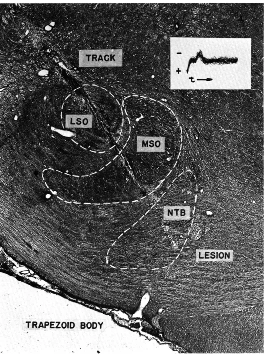 Fig.  XVIII-5. Micrograph  of  electrode  track  leading  to  the  nucleus  of  the  trapezoid body