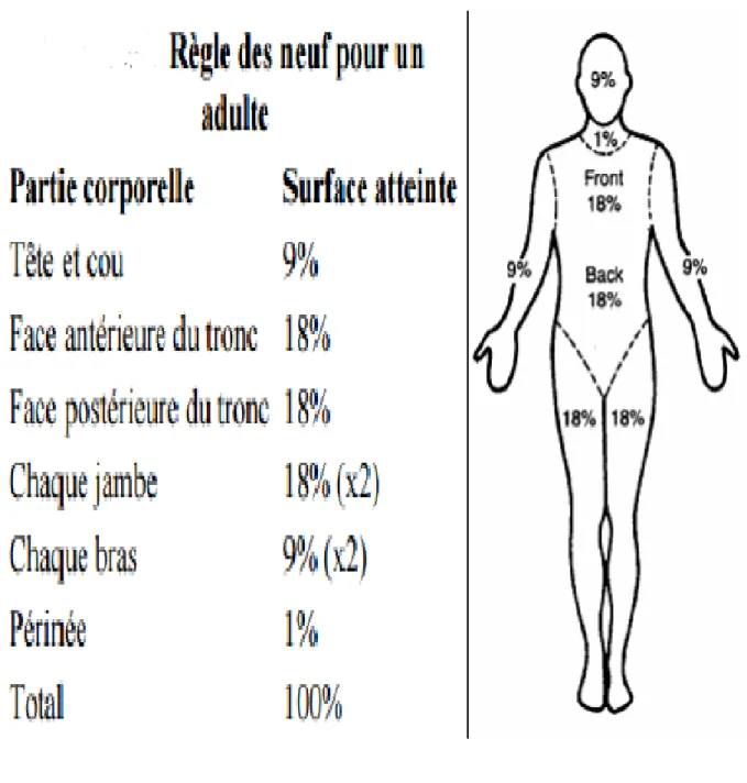 Figure 8 : Règle des neuf de Wallace (5) 