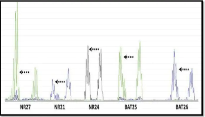 Figure 5: Phénotype MSI mis en évidence par amplification de 5 marqueurs. 