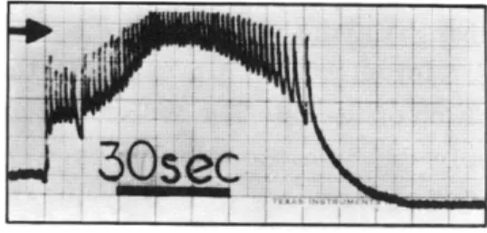 Fig.  9.  Single  sequence  from  a  DC  amplified microelectrode  (20  Ml2, <1  L tip)  recording of  spontaneous  slow  signals  from  explant telencephalon  from  14-day  chick  embryo after  1  day  in  culture