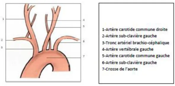 Figure 5: Naissance de l’artère vertébrale directement de la crosse de l’aorte 