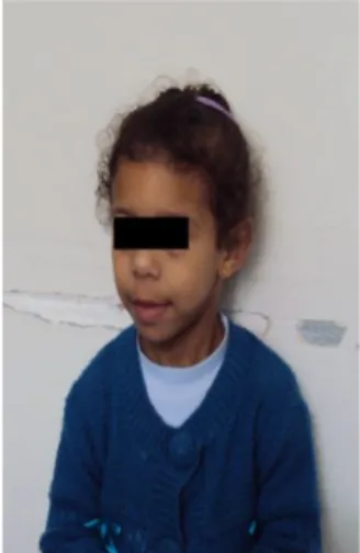 Figure 7 : photo de la fille E.M (unité de cardio -pédiatrie à L’Hôpital d’Enfant de  Rabat)