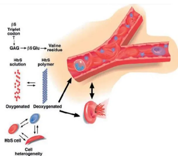 Figure 9 : physiopathologie de la drépanocytose 