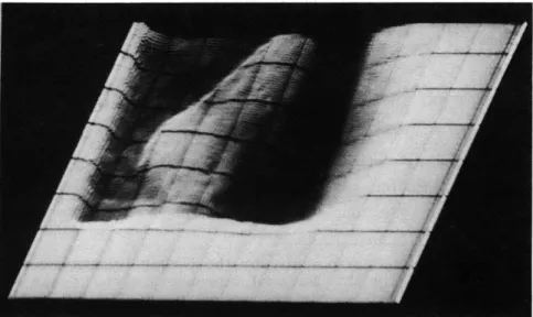 Fig.  XII-  1. Rescan  of  a  single  frame  from  a  motion  picture  of  a  fluoroscopic image  of  the  left  ventricle  of  the  human  heart