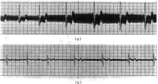 Fig.  XII-6. (a)  Input.  Electrocardiogram  signal  with  60-Hz  power  line interference.