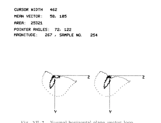 Fig.  XII-7.  Nornal  horizontal  plane  vector  loop.