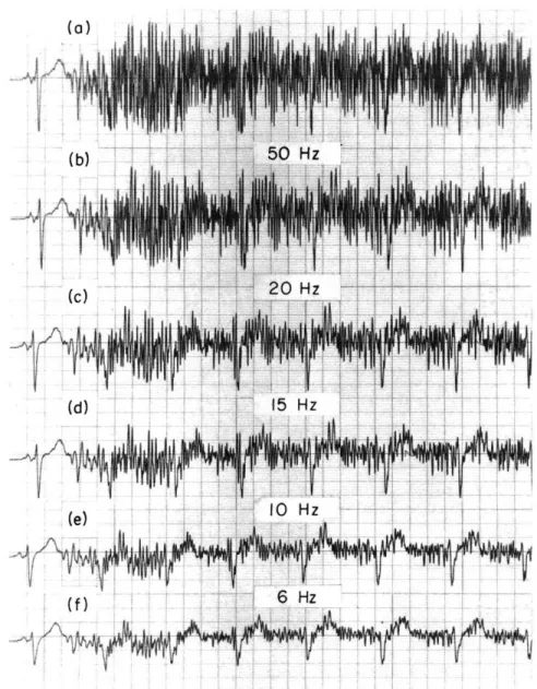 Fig.  XXIII-7. Effects  of  6  dB/octave  lowpass  filtering  of  an  excessively  noisy  EKG.