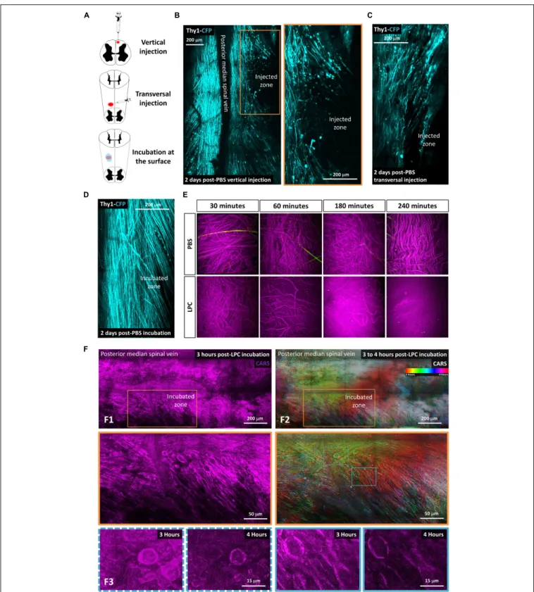 FIGURE 1 | Lysophosphatidylcholine incubation on the spinal cord surface avoids artifactual mechanical insult to axons