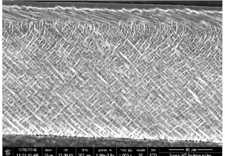 Figure 4 Normal enamel prism of lower incisor in mouse.  