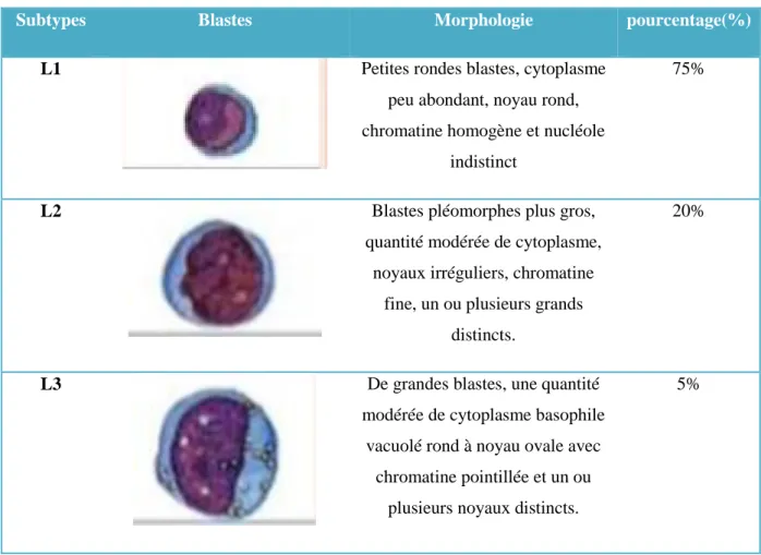 Tableau 3 : Classification FAB des LAL 