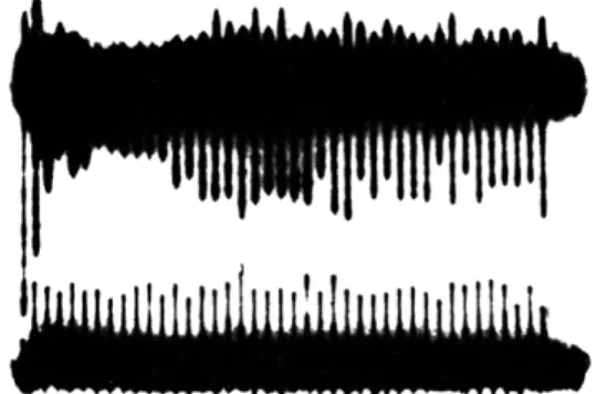 Fig.  XVIII-3.  Responses  to  clicks  delivered  at  a  rate  of  10/sec,  recorded  simul- simul-taneously  at  the  cortex  and  the  periphery