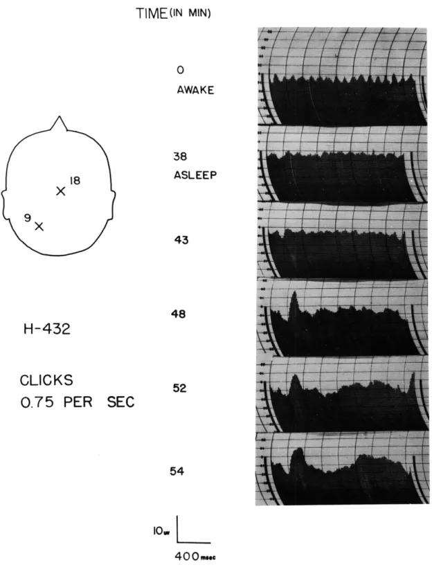 Fig.  XVI-12. Development  of  the  K-complex  in  sleep.  Stimulus,  a  medium- medium-intensity  click  delivered  binaurally
