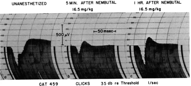 Fig.  XVI-9.  Effects  of  intravenous  nembutal  on  the  configuration  of the  averaged evoked  cortical  responses