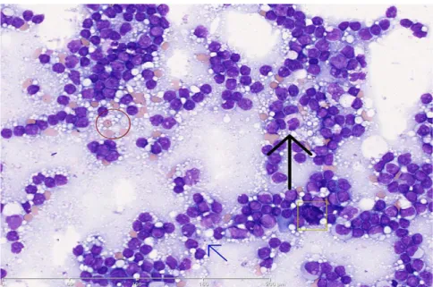 Figure 14. Coloration considérée comme optimale : les hématies (cercle rouge) sont rose orangé ou «  chamois », le cytoplasme des polynucléaires est quasi transparent et les granulations bien visibles  (flèche noire), les granulations des mastocytes sont v