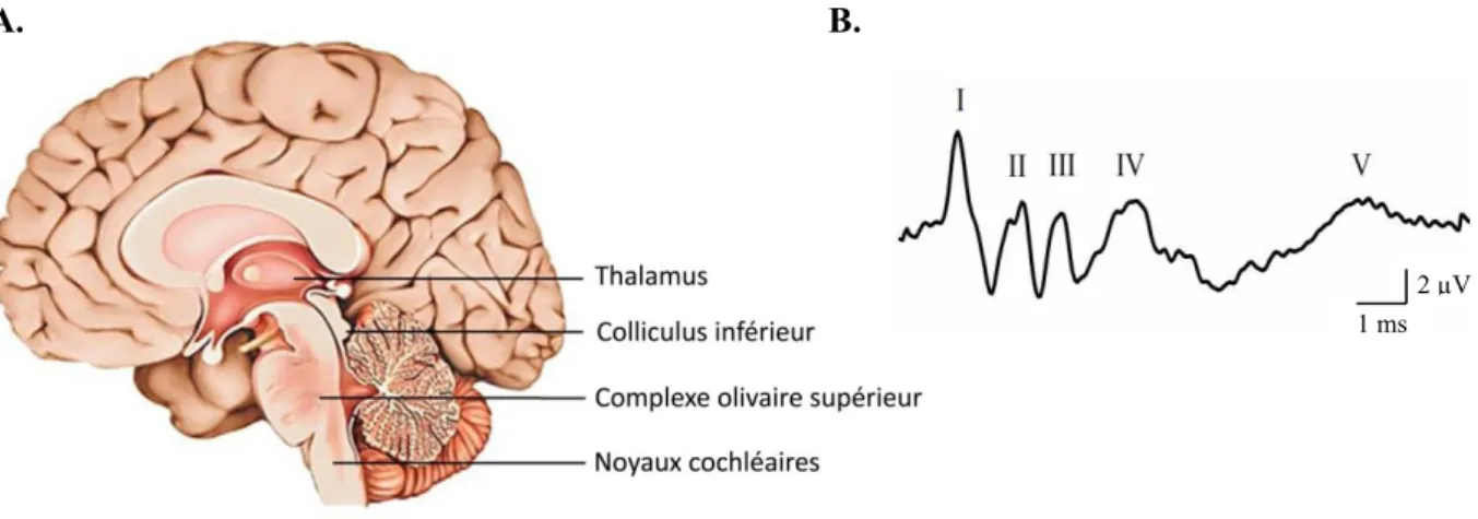 Figure 6 : Les différents relais de la voie auditive. A)  Schéma d'une coupe sagittale de l'encéphale  humain où sont situés les relais synaptiques de la voie auditive