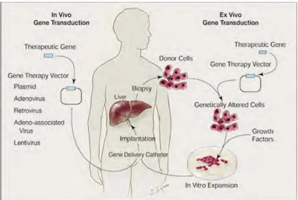Figure 6 : Thérapie génique in-vivo et ex-vivo[21]. 