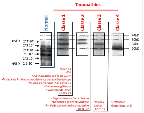 Figure 6 : « Le code barre » des Tauopathies :  