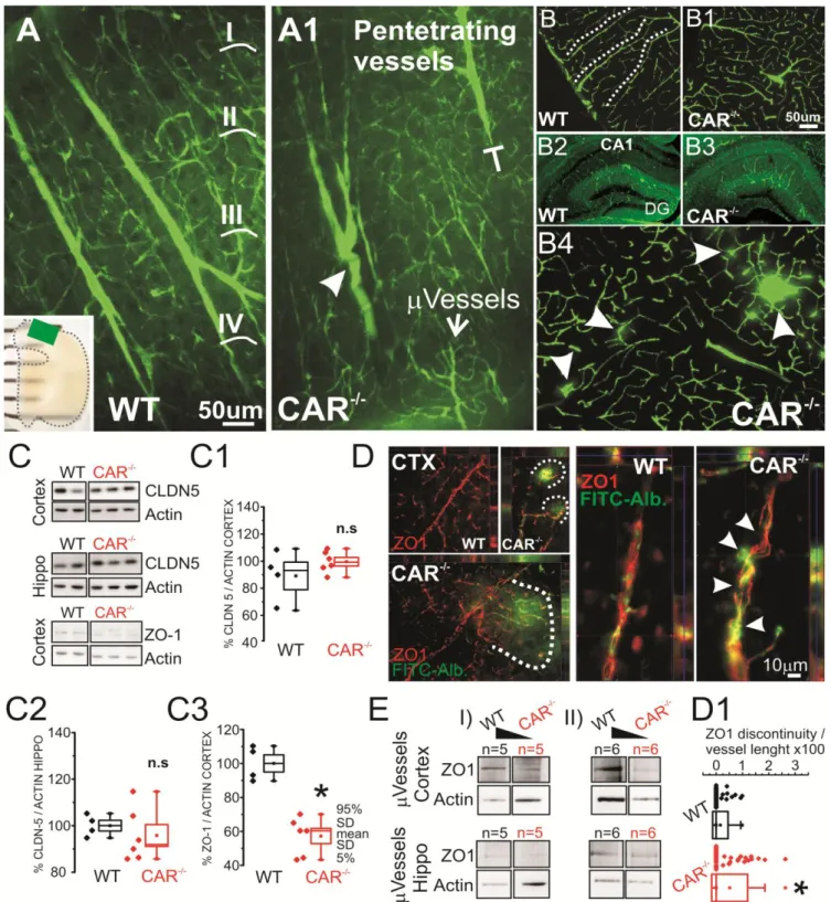 Figure 4. Cerebrovascular morphology and tight junction expression in CAR -/-  mice. A-A1) 2-photon images  obtained  from  SeeDB  transparent  brain  preparations  (ROI  in  the  insert)