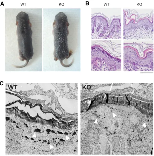 Fig. 4. Macroscopic, histological and ultrastructural phenotype of the Dmkn (b/c) 2/2 mice