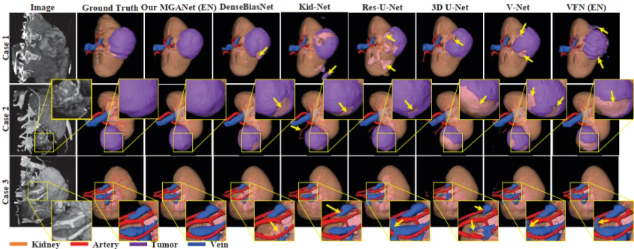 Figure 8: The qualitative evaluation illustrates the visual superiority of our proposed MGANet