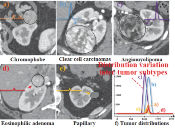 Figure 2: Narrow task-dependent distribution makes original CTA image low contrast and windowing on the distribution makes sub-window image fine-grained pattern