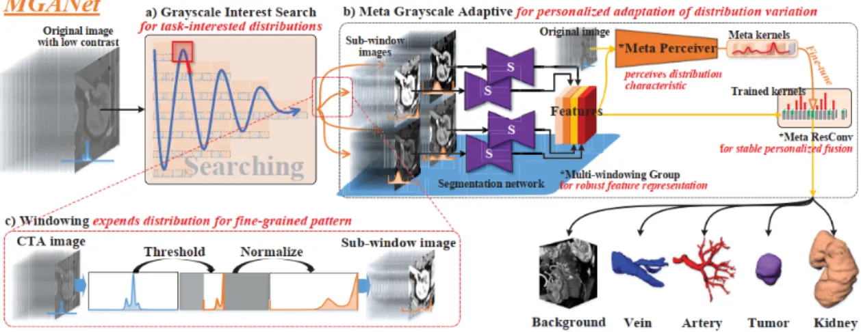 Figure 4: Our MGANet adaptively optimizes the grayscale distribution of medical images via our GIS strategy and MGA learning, achieving the 3D IRS segmentation
