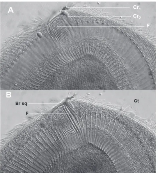 Figure 10. – Photographie  de  Dicoelophrya  mediovacuolata  n. sp. 