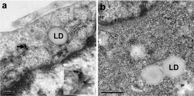 Fig. 2. Electron micrographs of BHK-21 cells producing the HCV core 1a Y164F (a) or  β - -galactosidase (b) proteins