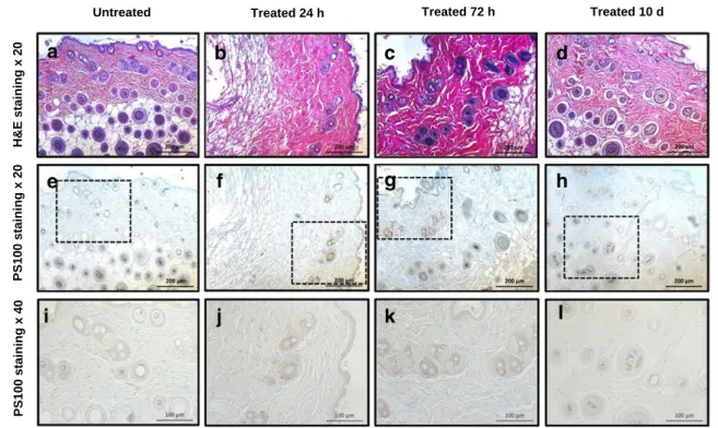 Figure 6. Skin histology in B16BL6-bearing mice at 24 hours, 72 hours, and 10 days of protocol