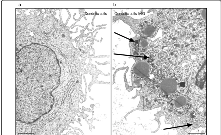 Fig. 3 Transmission electron microscopic analysis of autophagic organelles induced by IVIG in dendritic cells