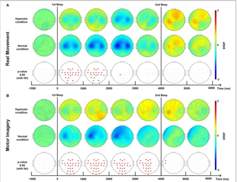 FIGURE 5 | Topographic maps of ERD/ERS% (grand average, n = 23) in the Beta band (15–30 Hz) for a real movement (A) and a motor imagery (B) during two conditions: normal and hypnotic